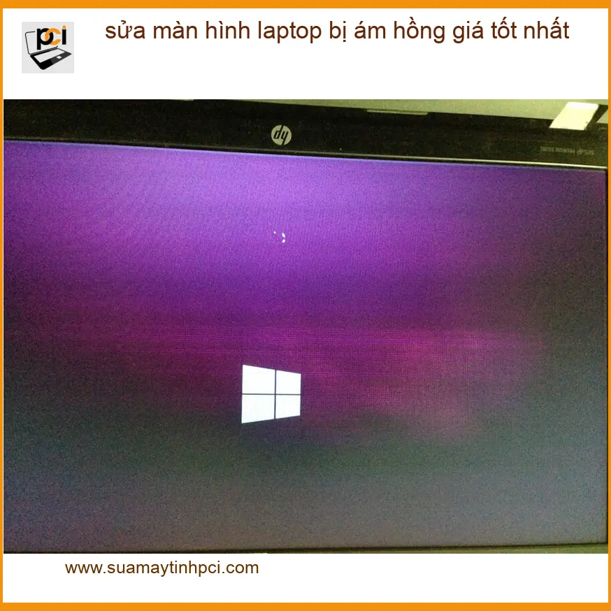 Sửa màn hình laptop bị ám hồng TPHCM – Địa chỉ uy tín, giá tốt nhất