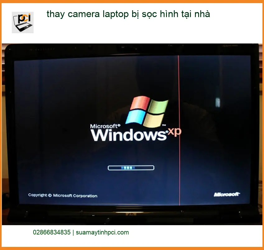 Sửa Laptop thay camera bị sọc hình tại nhà – Dịch vụ tận nơi TPHCM